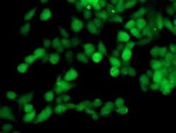 TOMM34 Monoclonal Antibody (OTI2A9), TrueMAB , OriGene 30 &mu;L; Unconjugated:Antibodies,