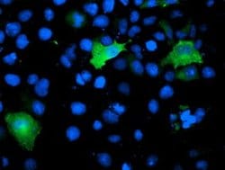TOMM34 Monoclonal Antibody (OTI1B6), TrueMAB , OriGene 30 &mu;L; Unconjugated:Antibodies,