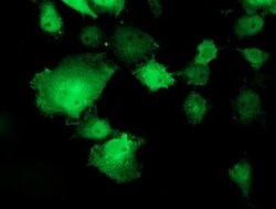 TOMM34 Monoclonal Antibody (OTI1B4), TrueMAB , OriGene 100 &mu;L; Unconjugated:Antibodies,
