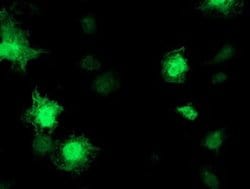 TOMM34 Monoclonal Antibody (OTI2B5), TrueMAB , OriGene:Antibodies:Primary