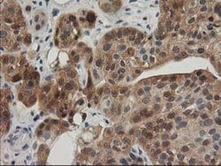 TOMM34 Monoclonal Antibody (OTI2A9), TrueMAB , OriGene 30 &mu;L; Unconjugated:Antibodies,