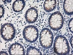 TOMM34 Monoclonal Antibody (OTI2A9), TrueMAB , OriGene 30 &mu;L; Unconjugated:Antibodies,