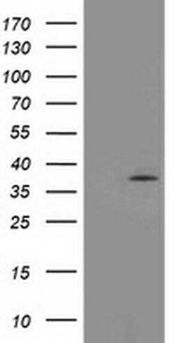 TOMM34 Monoclonal Antibody (OTI 2E11), TrueMAB , OriGene 30 &mu;L; Unconjugated:Antibodies,