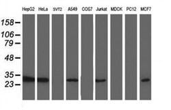 TOMM34 Monoclonal Antibody (OTI2A9), TrueMAB , OriGene 30 &mu;L; Unconjugated:Antibodies,