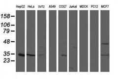 TOMM34 Monoclonal Antibody (OTI1B6), TrueMAB , OriGene 30 &mu;L; Unconjugated:Antibodies,