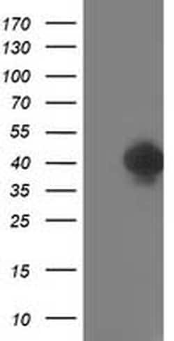 TOMM34 Monoclonal Antibody (OTI1B4), TrueMAB , OriGene 100 &mu;L; Unconjugated:Antibodies,