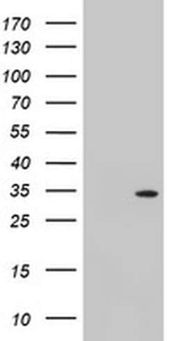 TOMM34 Monoclonal Antibody (OTI2D8), TrueMAB , OriGene:Antibodies:Primary