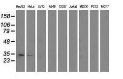 TOMM34 Mouse anti-Human, Clone: OTI2D8, lyophilized, TrueMAB 100 &mu;g;