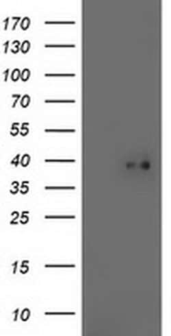 TOMM34 Monoclonal Antibody (OTI2B5), TrueMAB , OriGene:Antibodies:Primary