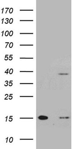 TOMM40L Monoclonal Antibody (OTI5B1), TrueMAB , OriGene:Antibodies:Primary