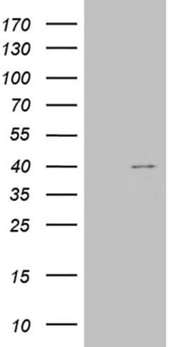 TOMM40L Monoclonal Antibody (OTI6F3), TrueMAB , OriGene:Antibodies:Primary