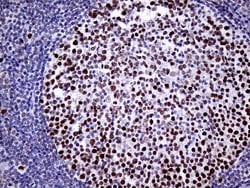 TOP1 Monoclonal Antibody (OTI3B9), TrueMAB , OriGene 100 &mu;L; Unconjugated:Antibodies,