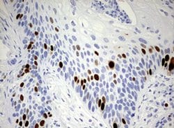 TOP2A Monoclonal Antibody (OTI1D5), TrueMAB , OriGene 100 &mu;L; Unconjugated:Antibodies,
