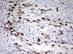 TOP2A Monoclonal Antibody (OTI1D5), TrueMAB , OriGene 100 &mu;L; Unconjugated:Antibodies,