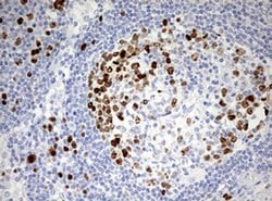 TOP2A Monoclonal Antibody (OTI1D5), TrueMAB , OriGene 100 &mu;L; Unconjugated:Antibodies,