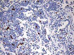 TOP2A Monoclonal Antibody (OTI1D5), TrueMAB , OriGene 100 &mu;L; Unconjugated:Antibodies,