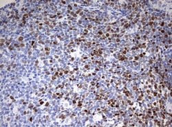 TOP2A Monoclonal Antibody (OTI1D5), TrueMAB , OriGene 100 &mu;L; Unconjugated:Antibodies,