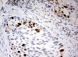 TOP2A Mouse anti-Human, Clone: OTI9E1, lyophilized, TrueMAB 100 &mu;g;