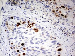TOP2A Monoclonal Antibody (OTI9E1), TrueMAB , OriGene 100 &mu;L; Unconjugated:Antibodies,