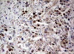 TOP2A Mouse anti-Human, Clone: OTI9E1, lyophilized, TrueMAB 100 &mu;g;