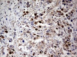 TOP2A Monoclonal Antibody (OTI9E1), TrueMAB , OriGene 100 &mu;L; Unconjugated:Antibodies,