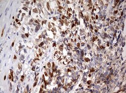 TOP2A Monoclonal Antibody (OTI9E1), TrueMAB , OriGene 100 &mu;L; Unconjugated:Antibodies,