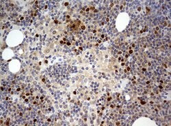 TOP2A Mouse anti-Human, Clone: OTI9E1, lyophilized, TrueMAB 100 &mu;g;