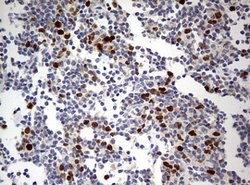 TOP2A Mouse anti-Human, Clone: OTI9E1, lyophilized, TrueMAB 100 &mu;g;