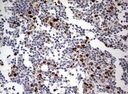 TOP2A Monoclonal Antibody (OTI9E1), TrueMAB , OriGene 100 &mu;L; Unconjugated:Antibodies,