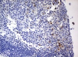 TOP2A Mouse anti-Human, Clone: OTI9E1, lyophilized, TrueMAB 100 &mu;g;