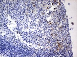 TOP2A Monoclonal Antibody (OTI9E1), TrueMAB , OriGene:Antibodies:Primary