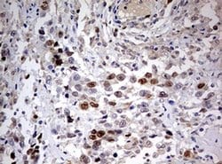 TOP2A Monoclonal Antibody (OTI6B4), TrueMAB , OriGene 30 &mu;L; Unconjugated:Antibodies,