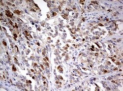 TOP2A Monoclonal Antibody (OTI6B4), TrueMAB , OriGene 30 &mu;L; Unconjugated:Antibodies,