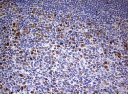 TOP2A Monoclonal Antibody (OTI6B4), TrueMAB , OriGene 30 &mu;L; Unconjugated:Antibodies,