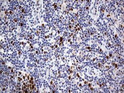 TOP2A Monoclonal Antibody (OTI1B10), TrueMAB , OriGene 100 &mu;L; Unconjugated:Antibodies,