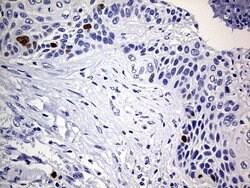 TOP2A Mouse anti-Human, Clone: OTI19D4, lyophilized, TrueMAB 100 &mu;g;