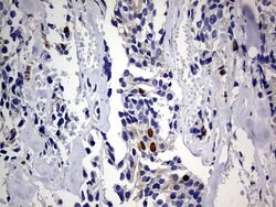 TOP2A Mouse anti-Human, Clone: OTI19D4, lyophilized, TrueMAB 100 &mu;g;