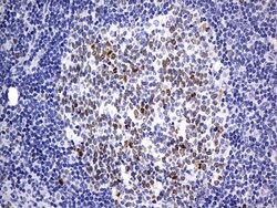 TOP2A Mouse anti-Human, Clone: OTI19D4, lyophilized, TrueMAB 100 &mu;g;
