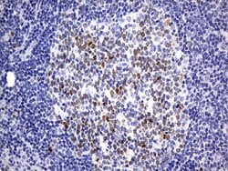 TOP2A Monoclonal Antibody (OTI19D4), TrueMAB , OriGene 30 &mu;L; Unconjugated:Antibodies,