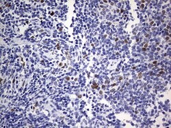 TOP2A Mouse anti-Human, Clone: OTI19D4, lyophilized, TrueMAB 100 &mu;g;