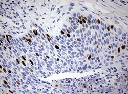 TOP2A Monoclonal Antibody (OTI3E11), TrueMAB , OriGene 100 &mu;L; Unconjugated:Antibodies,