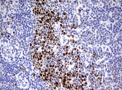 TOP2A Monoclonal Antibody (OTI3E11), TrueMAB , OriGene 100 &mu;L; Unconjugated:Antibodies,