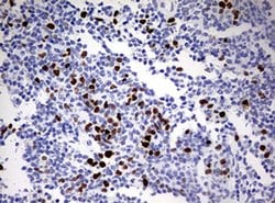 TOP2A Monoclonal Antibody (OTI3E11), TrueMAB , OriGene 100 &mu;L; Unconjugated:Antibodies,