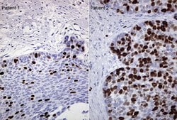 TOP2A Monoclonal Antibody (OTI3E11), TrueMAB , OriGene 100 &mu;L; Unconjugated:Antibodies,
