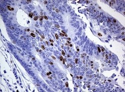 TOP2A Monoclonal Antibody (OTI3E11), TrueMAB , OriGene 100 &mu;L; Unconjugated:Antibodies,