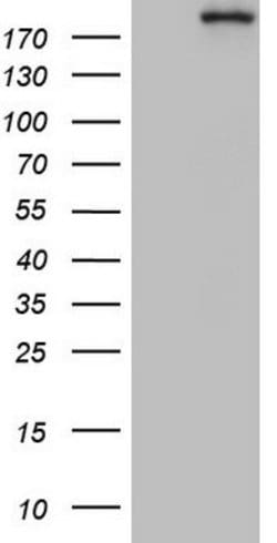 TOP2A Mouse anti-Human, Clone: OTI1D4, lyophilized, TrueMAB 100 &mu;g;