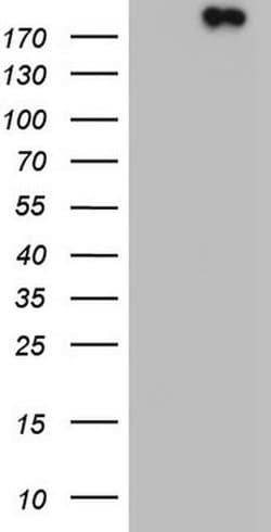 TOP2A Monoclonal Antibody (OTI1D5), TrueMAB , OriGene 100 &mu;L; Unconjugated:Antibodies,