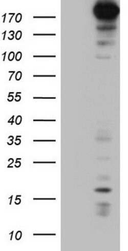 TOP2A Mouse anti-Human, Clone: OTI9E1, lyophilized, TrueMAB 100 &mu;g;