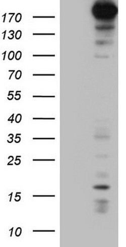 TOP2A Monoclonal Antibody (OTI9E1), TrueMAB , OriGene 100 &mu;L; Unconjugated:Antibodies,