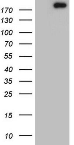 TOP2A Mouse anti-Human, Clone: OTI19D4, lyophilized, TrueMAB 100 &mu;g;